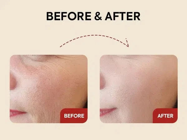 K-Secret Seoul 1988 Serum Retinal Liposome 2% + Black Ginseng 30ml