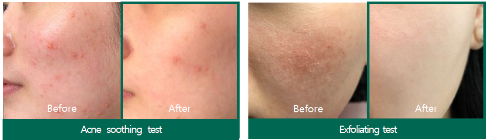 SOMEBYMI | AHA BHA PHA 30 DAYS MIRACLE ACNE CLEAR FOAM