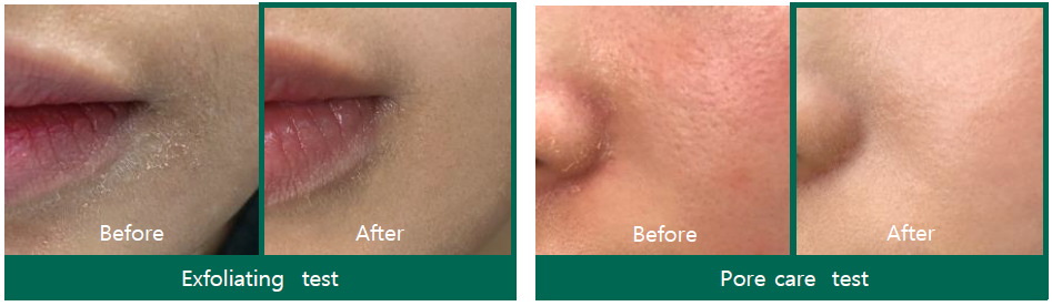 SOMEBYMI | AHA BHA PHA 30 DAYS MIRACLE TONER